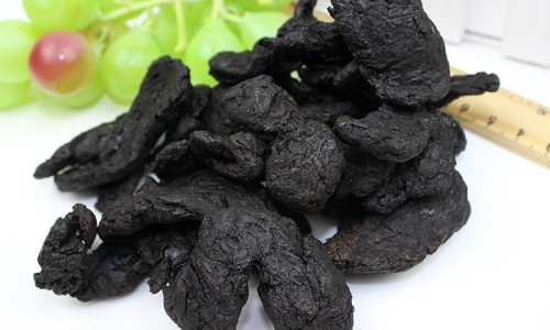 脸上长的痣可以去掉吗-脸上长痣图解代表什么网 - 脸上长痣越来越多什么原因,脸上长痣是什么原因造成的